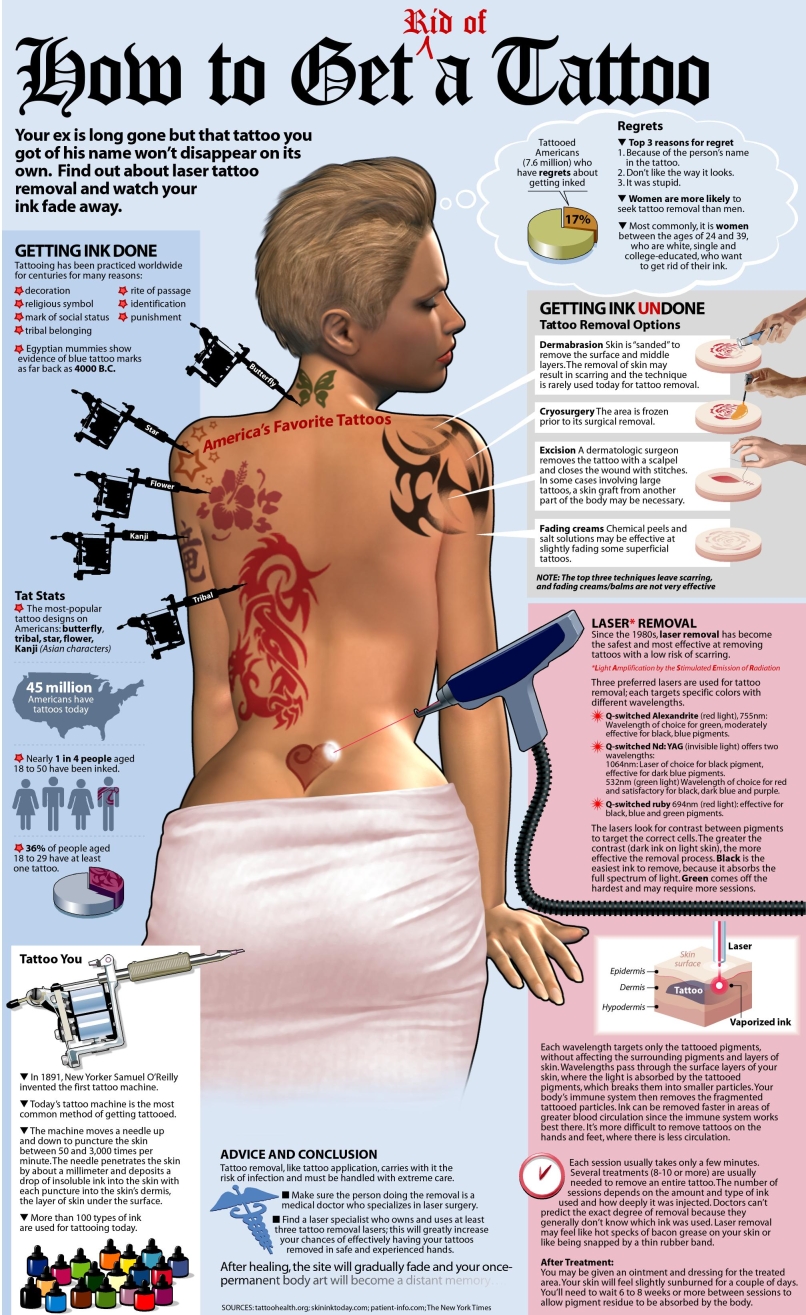 Laser Tattoo Removal | Eden Medical Aesthetics